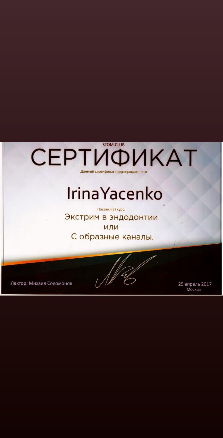 Лечение кариеса