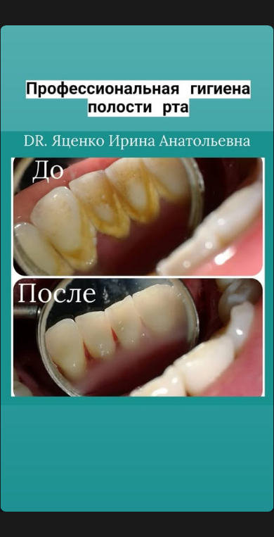 Клиническое фото до и после лечения