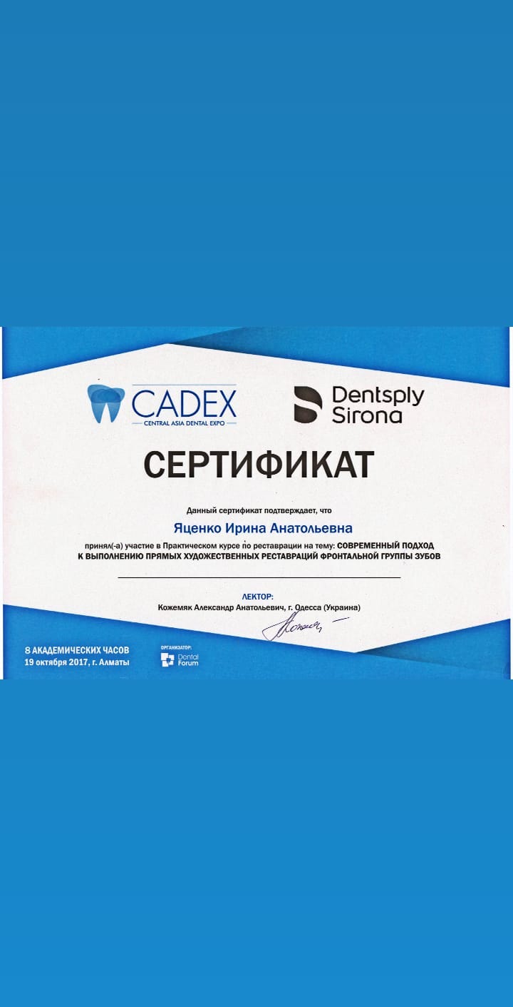 Лечение кариеса молочных зубов