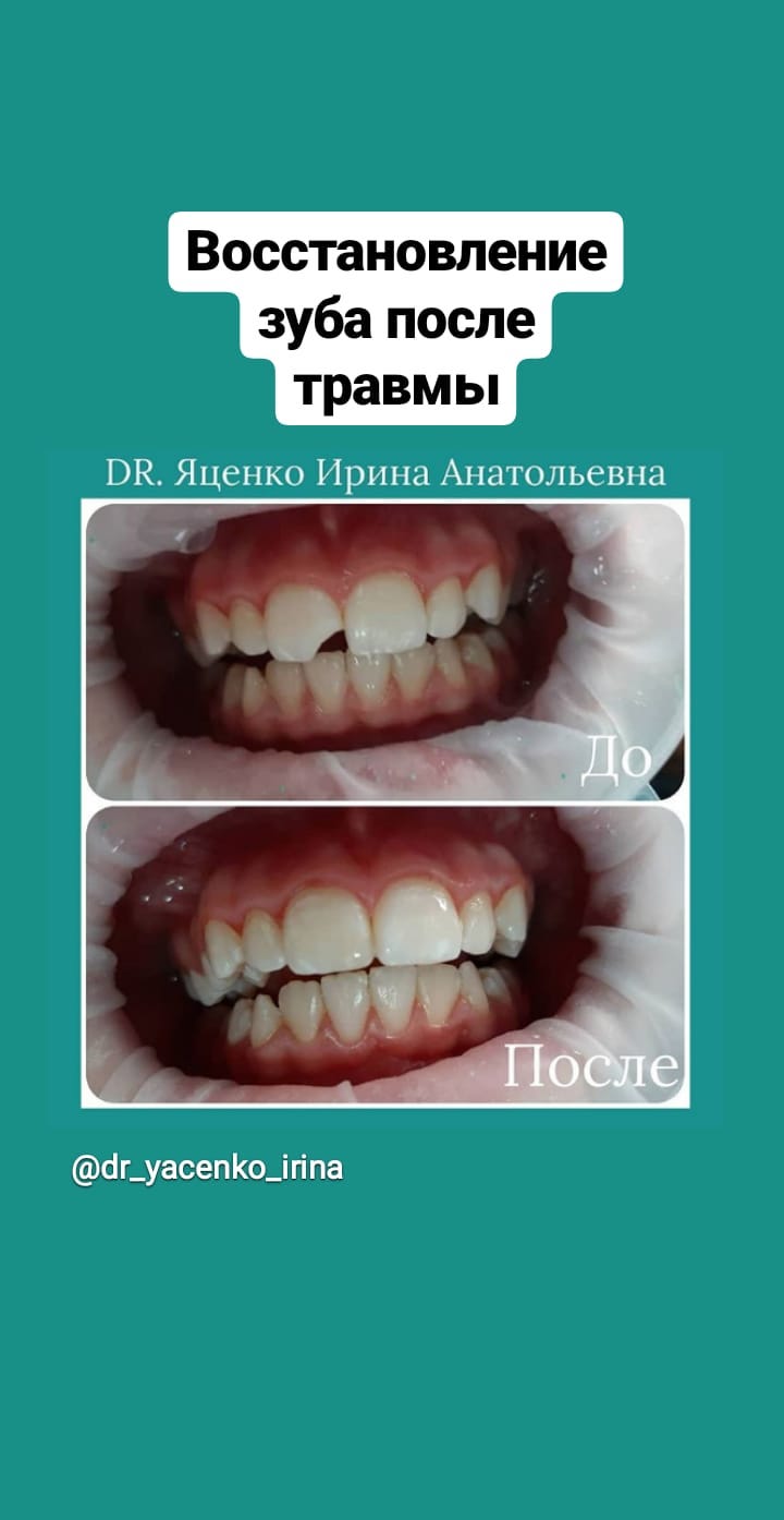 Лечение зубов в сознании