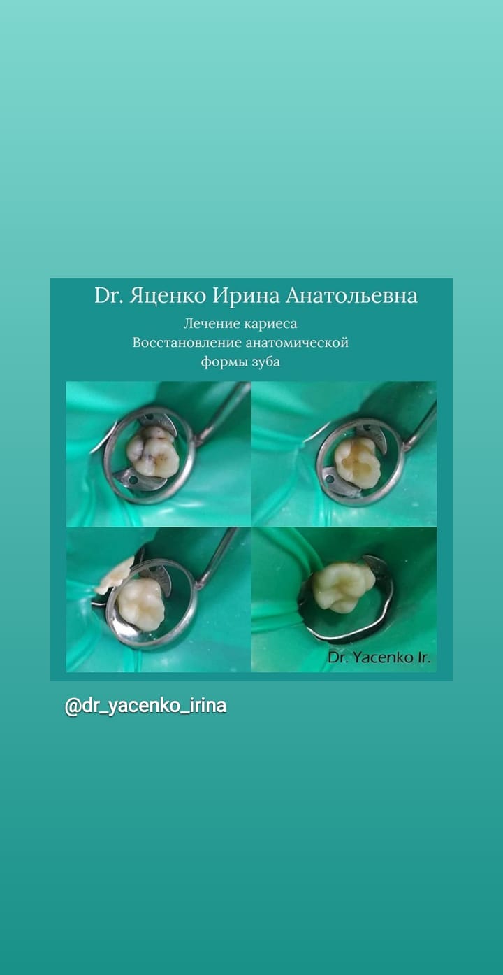 Профессиональная гигиена