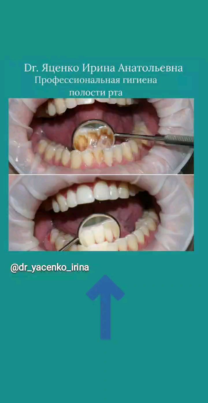 Профессиональная гигиена