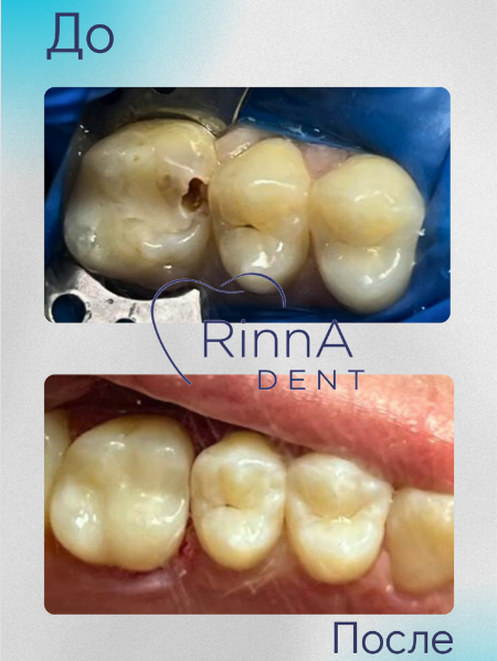 Профилактические осмотры